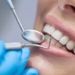 vizita la dentist