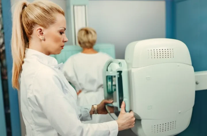 Exercițiile reduc riscul de recidivă la cancerul de colon